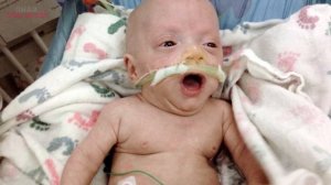 Самые крупные и крохотные младенцы в мире