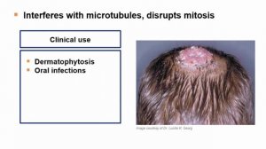 USMLE RX - 7.Микробиология - 1.Антимикробные средства - 36.Гризеофульвин