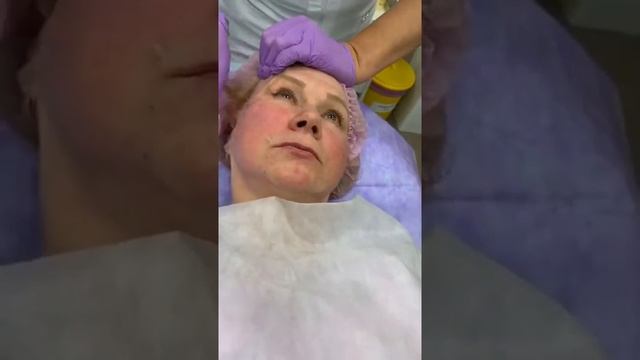 Контурная пластика в контексте современной инъекционной косметологии смотреть онлайн