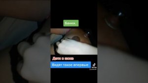 ставим банки от простуды. дети видят такое в первые #банки#банкиотпростуды