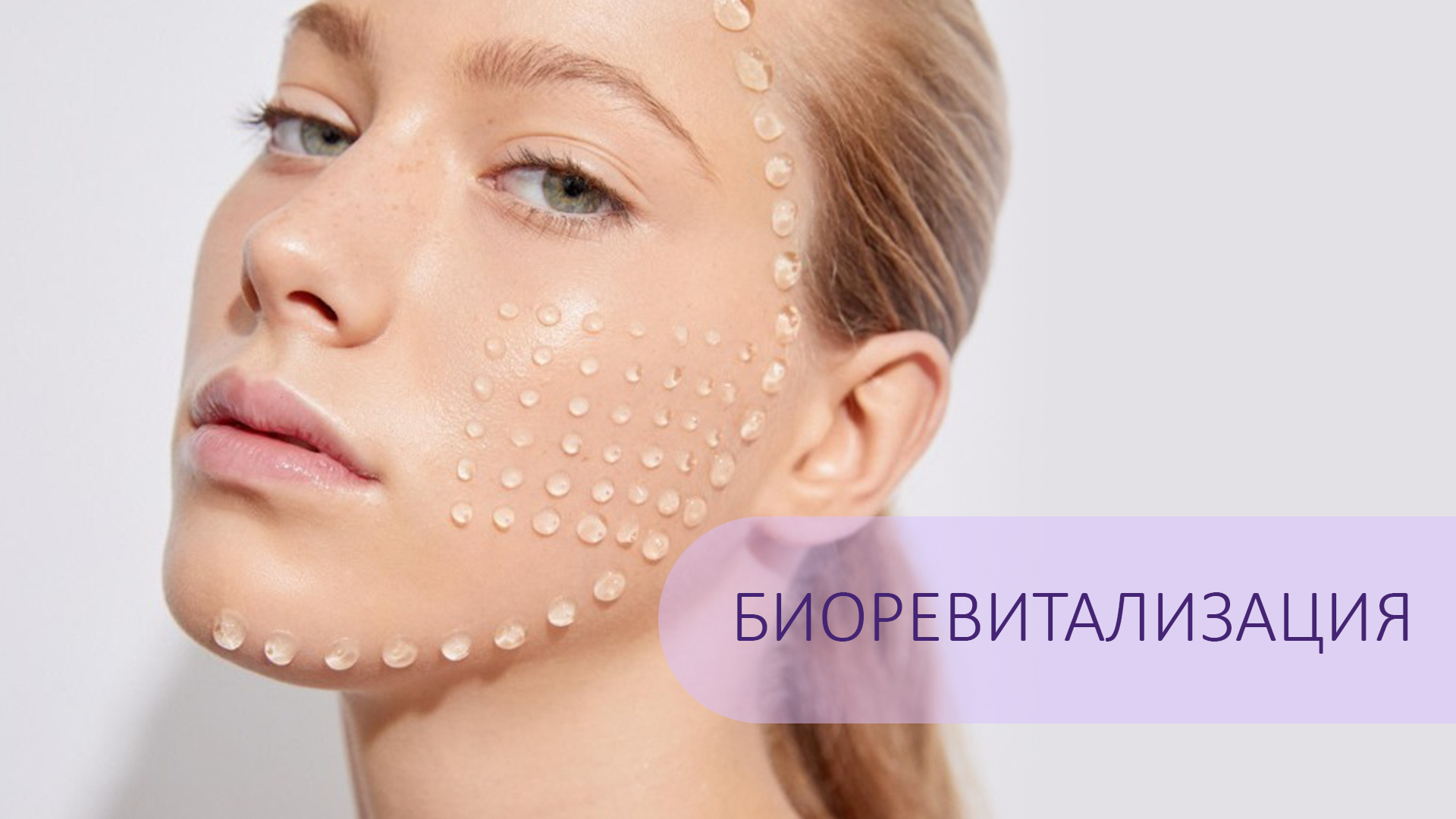 Биоревитализация