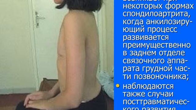 Вертикальная статика в норме и патологии смотреть онлайн