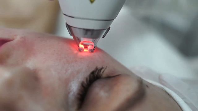 Аппаратная шлифовка и омоложение кожи "CLEAR + BRILLIANT" смотреть онлайн