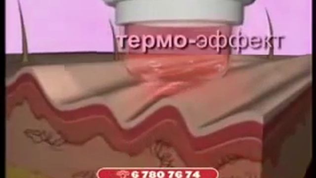 Аппарат для разглаживания морщин Derma Wand Дерма Ванд
