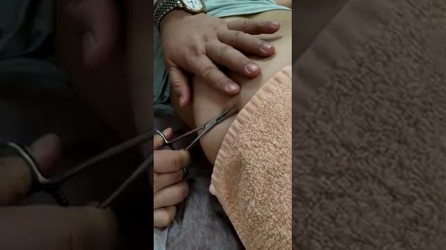 Обучение Т игла (2) в России смотреть онлайн