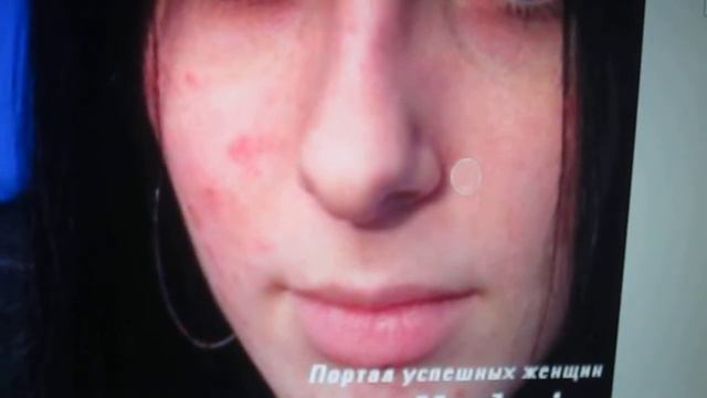 Уроки фотошопа. Избавляемся от дефектов кожи смотреть онлайн