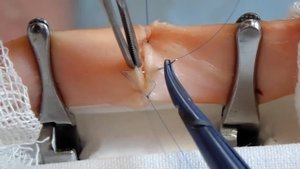 Сосудистый шов Карреля