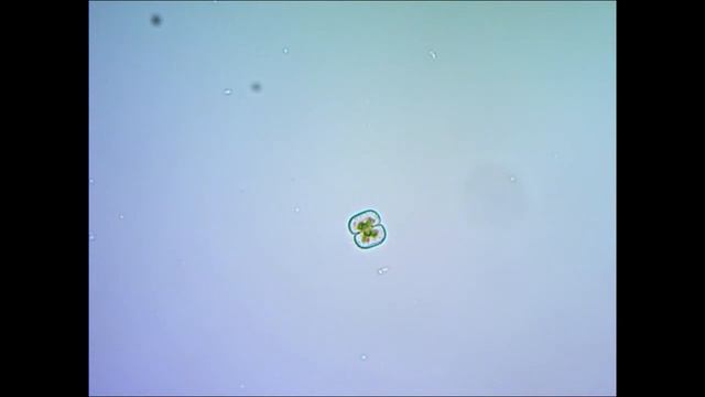 Цианобактерия под микроскопом under microscope