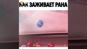 Как заживает рана. Интересное видео