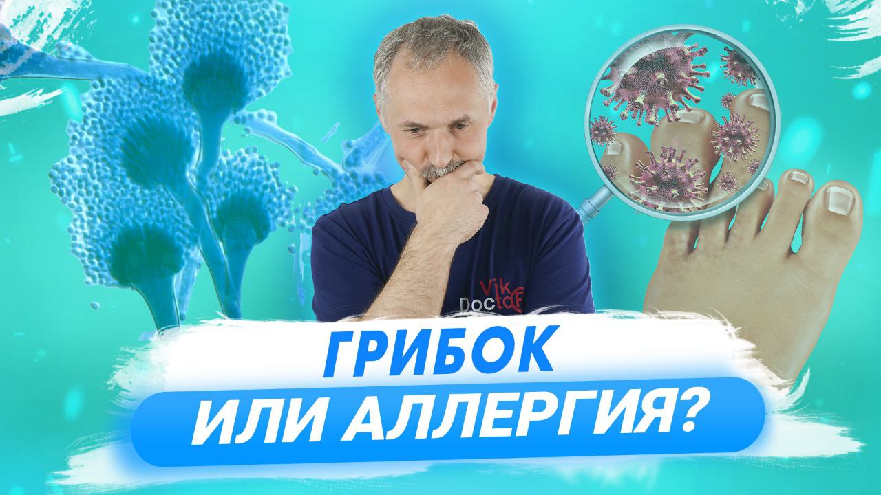 Грибок ногтей и кожи: лечение и профилактика / Доктор Виктор смотреть онлайн
