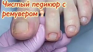 Чистый педикюр с ремувером