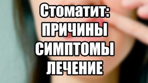 Стоматит: причины, симптомы, лечение заболевания.