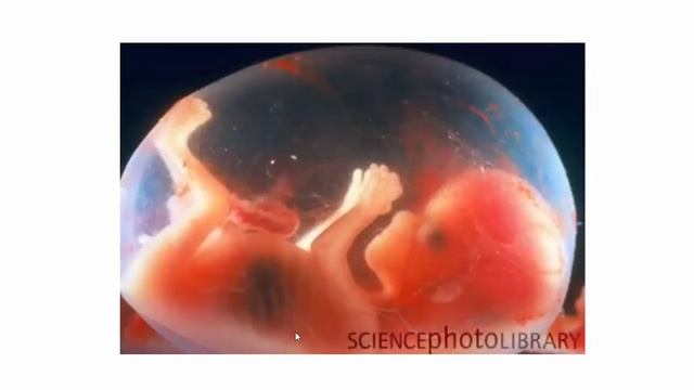 15 Пятнадцатая неделя беременности смотреть онлайн