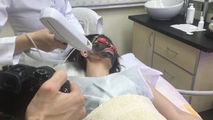 КАРБОНОВЫЙ ПИЛИНГ