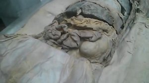 Тонкий и толстый кишечник. анатомия