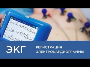 ЭКГ. Регистрация электрокардиограммы в клинике "Консилиум"