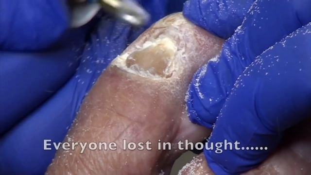 For how long? She Has Not Trimmed Her Toenails in 1-1/2 Years. (2020) смотреть онлайн