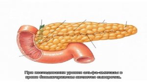 Анализ крови на альфа-амилазу