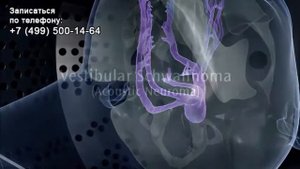 Гамма-нож — принцип действия