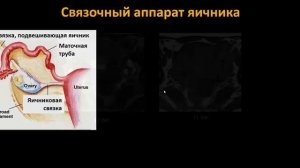 Базовый курс по МРТ  a  Лекция «МР анатомия женского таза и методика сбора данных»  Трофименко И А