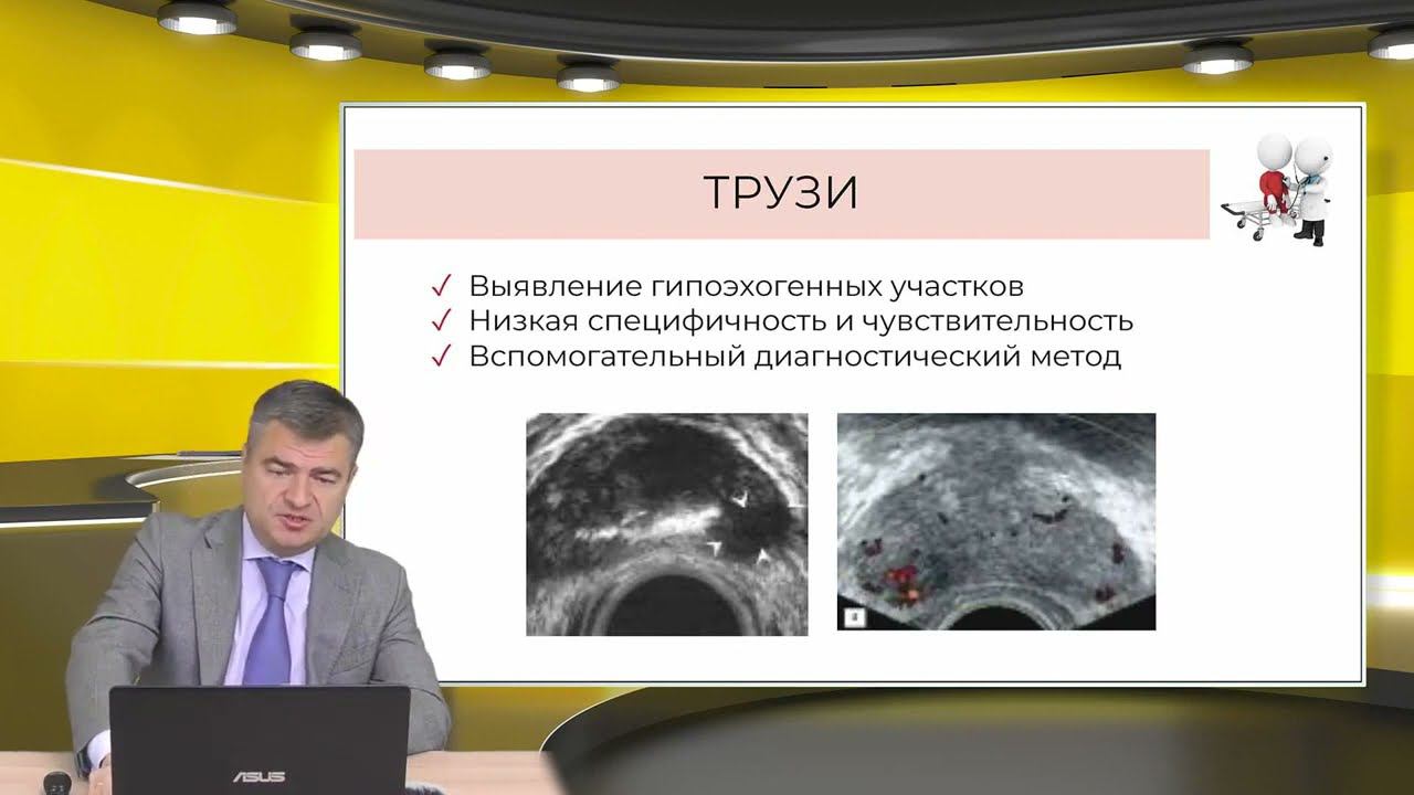 Рак предстательной железы диагностика, методы лечения