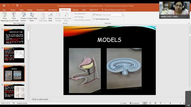 Development of GIT, Rotation of gut (Start from 31 mins) смотреть онлайн