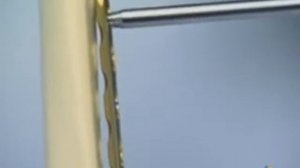Фиксация перелома голени пластиной с угловой стабильностью