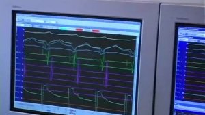 Радиочастотная абляция доп. путей проведения