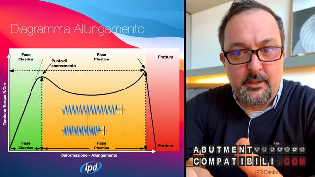 Le Viti in implantologia e odontoiatria, sbucciamo questo semplice oggetto scoprendone i segreti. смотреть онлайн