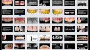 Вебинар разбор работ зубных техников, ссылка в описании