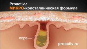 Дженнифер Лав Хьюитт о Proactiv