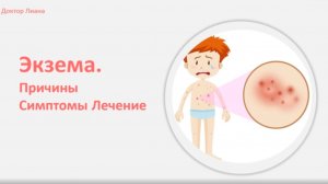 ЭКЗЕМА . Причины. Лечение медикаментозное и немедикаментозное.