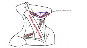 Треугольники Шеи