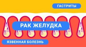 Врачи напомнили о коварстве хеликобактер пилори: вызывает рак