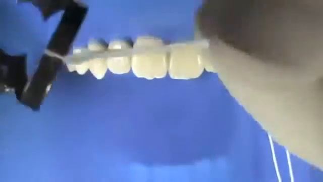 Работа с Коффердамом (Обучающее видео для стоматологов) смотреть онлайн