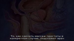 Как можно самому сделать массаж простаты: техники, правила, нюансы