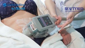 Криолиполиз CoolSculpting аппарате Zeltiq (Зелтик)