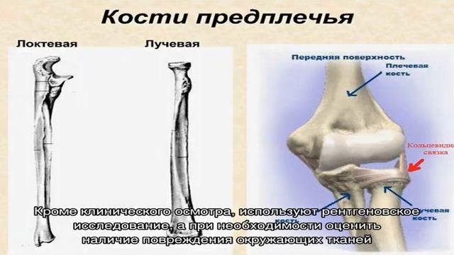 Кости предплечья