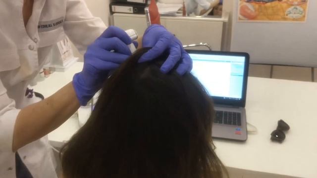 Консультация трихолога Осиповой Елены Анатольевны