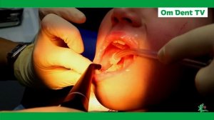 Приём у детского стоматолога