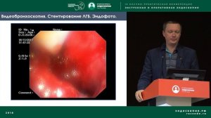 Ошибки бронхоскопии. Что пошло не так, и никогда не будет опубликовано