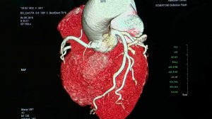 29 сентября - Всемирный день сердца