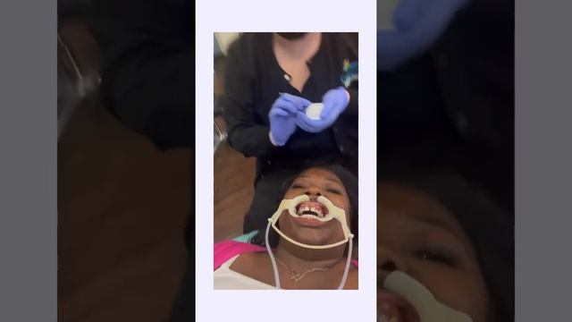 I got braces for the first time as an adult!*vlog* смотреть онлайн