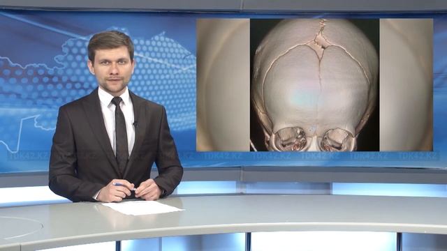 ВРАЧИ ВОССТАНОВИЛИ ЧЕРЕП МАЛЫШУ ПОСЛЕ УДАРА ПО ГОЛОВЕ смотреть онлайн