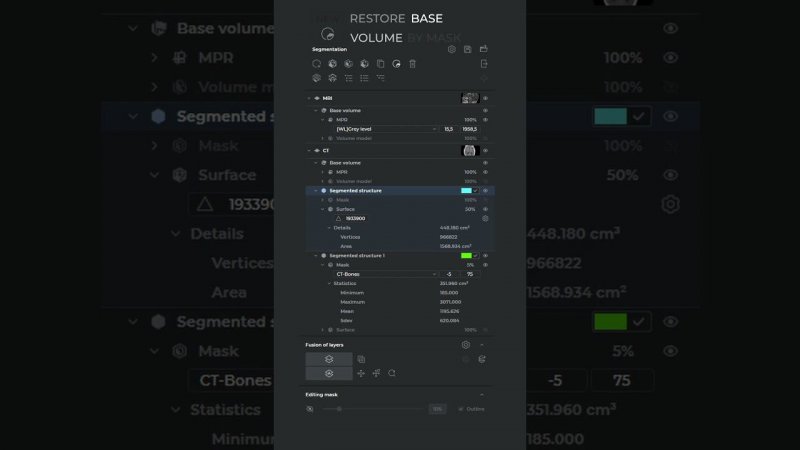 Inobitec DICOM Viewer: segmentation panel