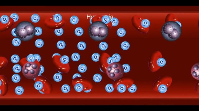 Hyperbaric Oxygen Indication-Sensory System смотреть онлайн