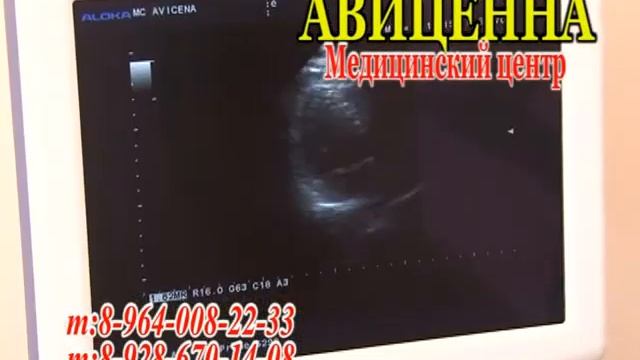 РЕКЛАМА Медицинского центра "АВИЦЕННА" смотреть онлайн