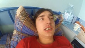 Славону из Kharkov Band СЛОМАЛИ ЧЕЛЮСТЬ