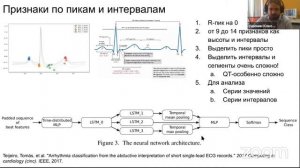 Обзор методов обработки ЭКГ