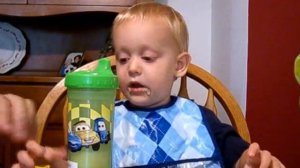 Krabbe Leukodystrophy (Before & After): Judson